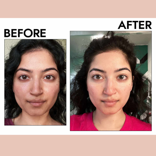 Lymphatic Contour Brush