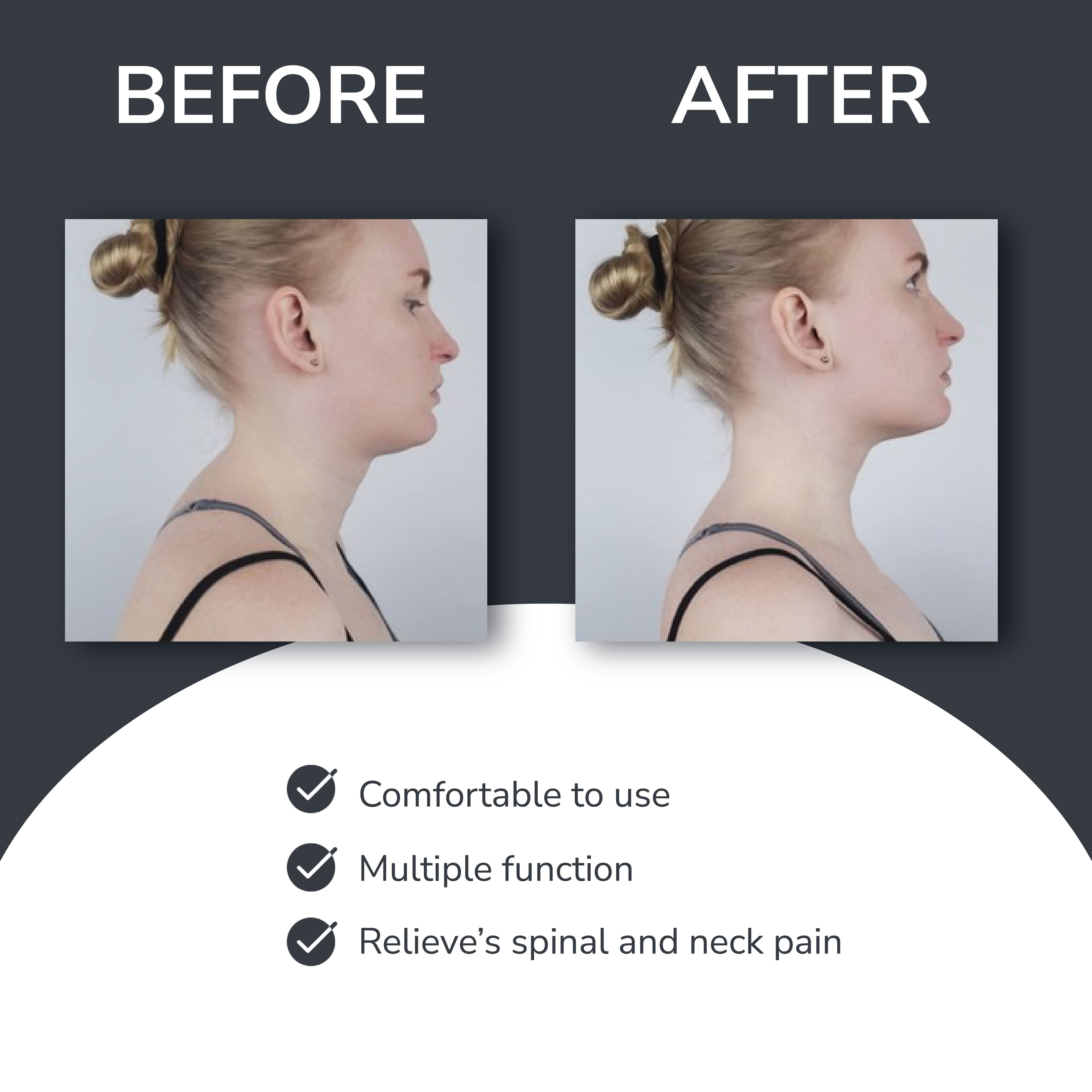 Vilda™ Neck Traction Device