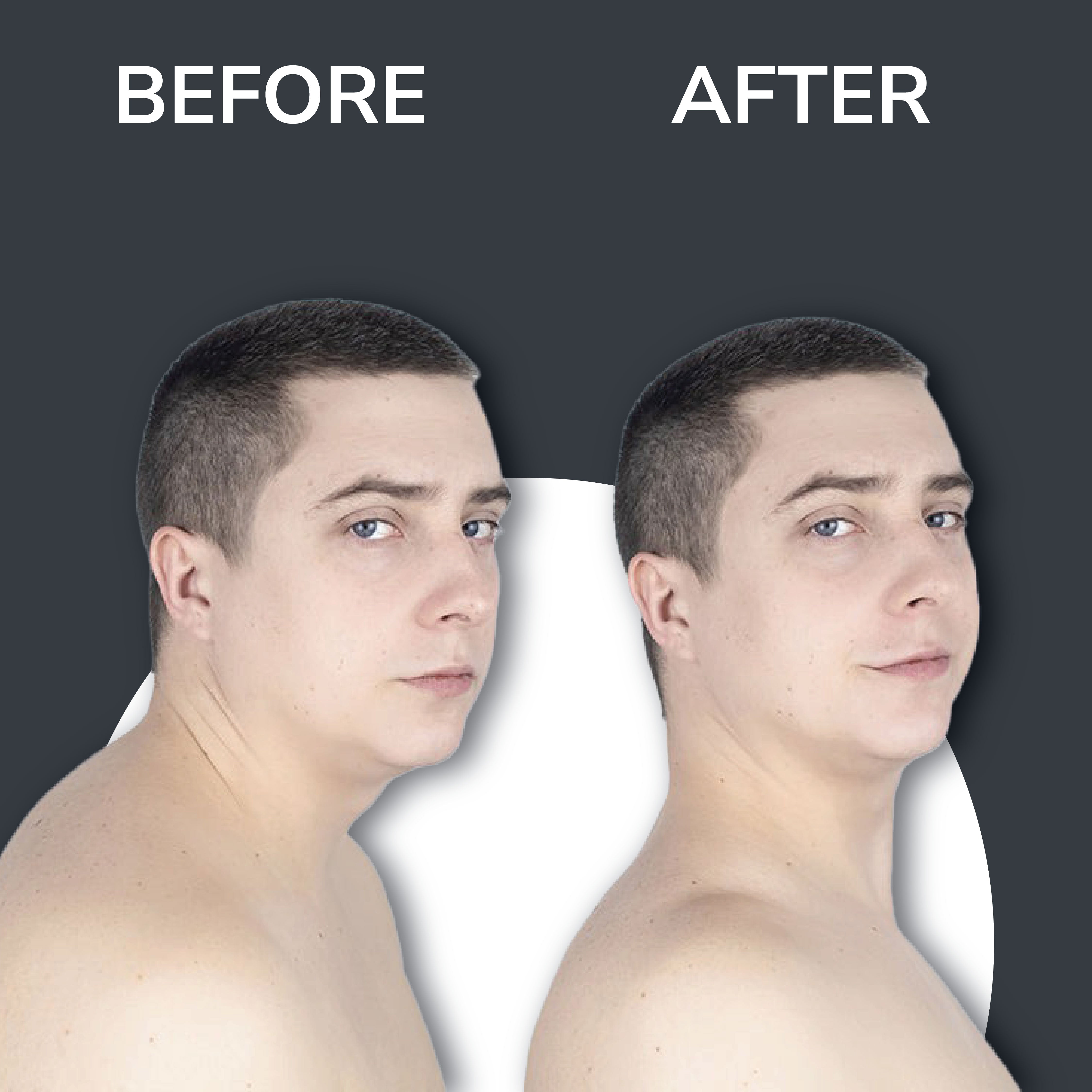 Vilda™ Neck Traction Device